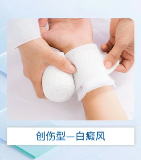 创伤型白癜风白斑病医院