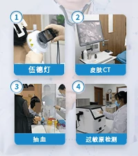 白癜风疾病百科