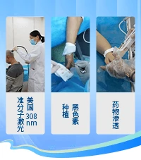 白癜风疾病百科