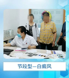 节段型白癜风白斑病
