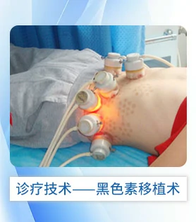白斑病白癜风诊疗技术