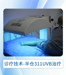 白斑病白癜风诊疗技术