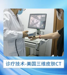 白斑病白癜风诊疗技术